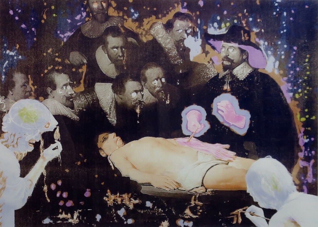 Rob Birza: Zeefdruk, De anatomieles - Ingelijst kopen? Bied vanaf 50!