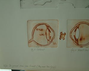Arend van Dam - Kleuren ets op papier, getiteld "De grauwe staar van Vincent" 12/15 kopen? Bied vanaf 15!