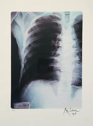 Rob Scholte - zeefdruk - Thorax - 1998 - oplage 75 ex. kopen? Bied vanaf 90!