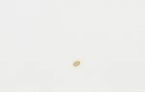 Nika Meerman - Ets en aquatint, Twee werelden van verschil (Groot) kopen? Bied vanaf 1!