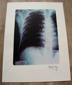 Rob Scholte - Zeefdruk: Thorax - 1998 kopen? Bied vanaf 1!