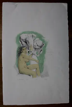 Herman Berserik - Litho - 1972 kopen? Bied vanaf 69!