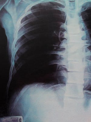 Rob Scholte - Zeefdruk: Thorax - 1998 kopen? Bied vanaf 1!