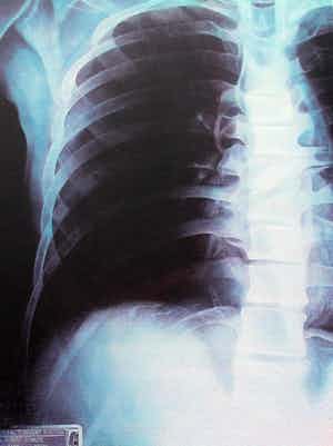 Rob Scholte - Zeefdruk: Thorax - 1998 verkocht voor € 1!