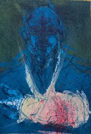 Ronald Tolman - Zelfportret met arm in gips, aquatint ets (kleine oplage) kaufen? Bieten Sie von 95!