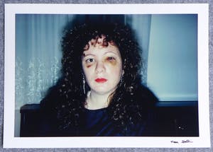 Nan Goldin - Autogramm auf Fotografie Nan one month after beeing battered kopen? Bied vanaf 49!